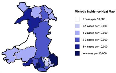 Microtia: A Data Linkage Study of Epidemiology and Implications for Service Delivery